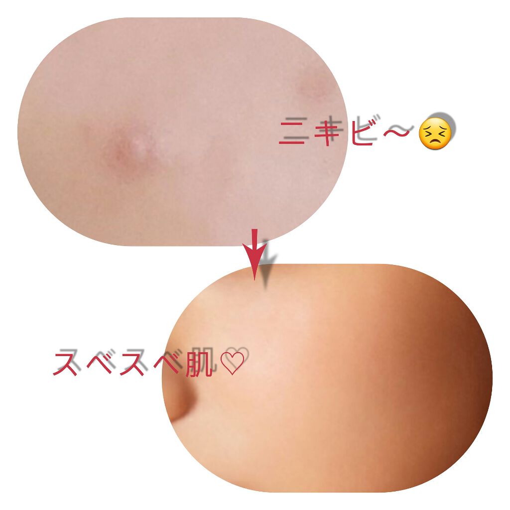 DHC はとむぎエキス/DHC/健康サプリメントを使ったクチコミ(2枚目)