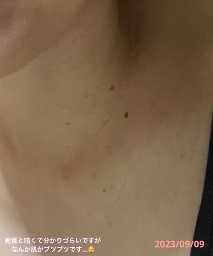 美容原液 オパール R-III/薬用 オパールR-Ⅲ/美容液を使ったクチコミ(9枚目)