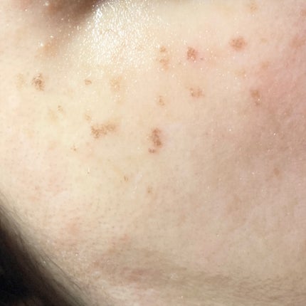 を使ったクチコミ(2枚目)