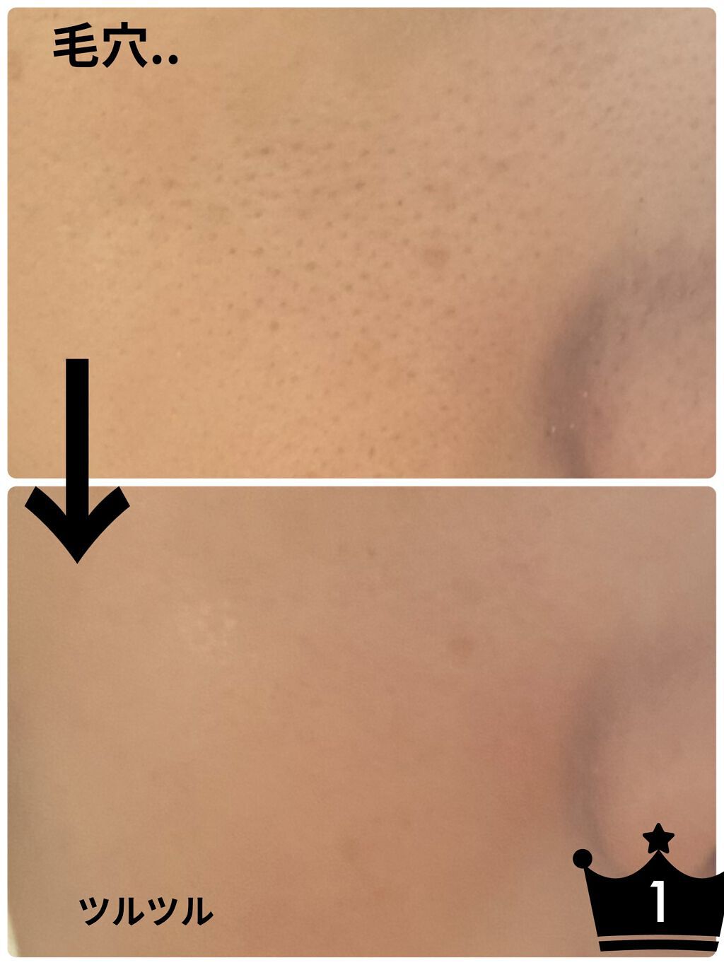 【旧】ディオールスキン フォーエヴァー スキン コレクト コンシーラー/Dior/リキッドコンシーラーを使ったクチコミ（1枚目）