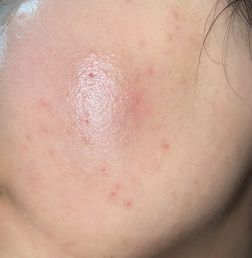 を使ったクチコミ（3枚目）