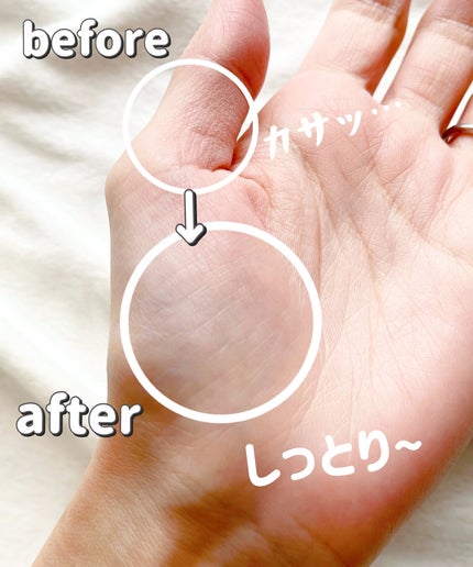 ベビークリーム/アトピタ/フェイスクリームを使ったクチコミ(4枚目)