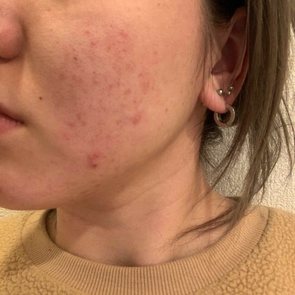 7 day Special Set プログラム3/b.glen/トライアルキットを使ったクチコミ(2枚目)