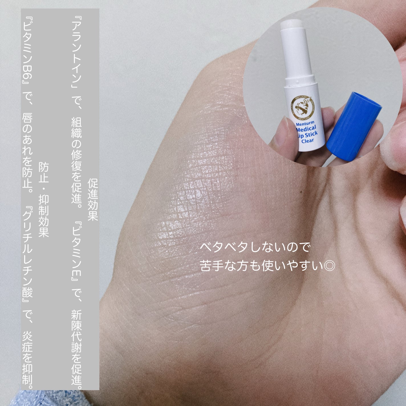 薬用メディカルリップスティックCn/メンターム/リップクリームを使ったクチコミ(2枚目)