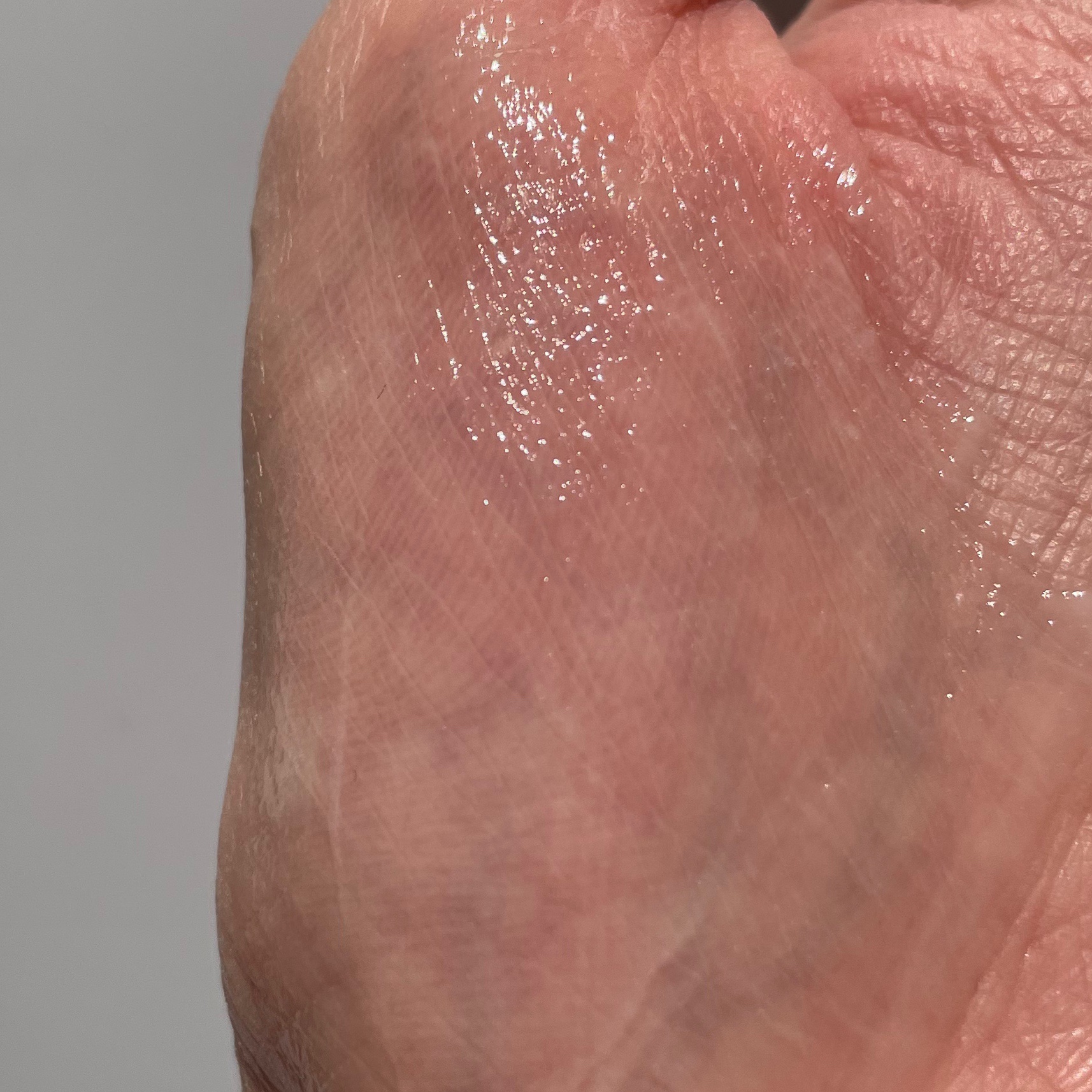 ボタレチノールユースリペアソリューションセット/ENPRANI（韓国）/美容液を使ったクチコミ（3枚目）