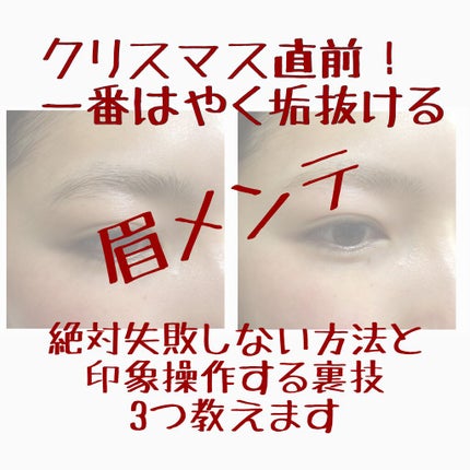 脱色クリーム 敏感肌用/エピラット/ムダ毛ケアを使ったクチコミ(1枚目)