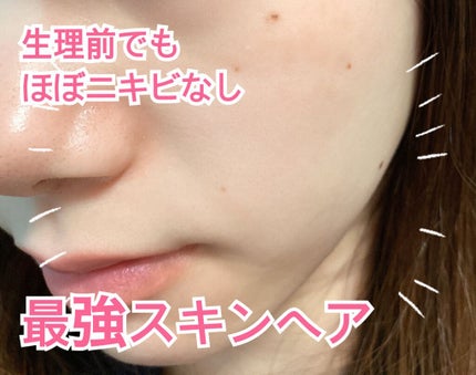 とろんと濃ジェル 薬用美白 N/なめらか本舗/オールインワン化粧品を使ったクチコミ(1枚目)