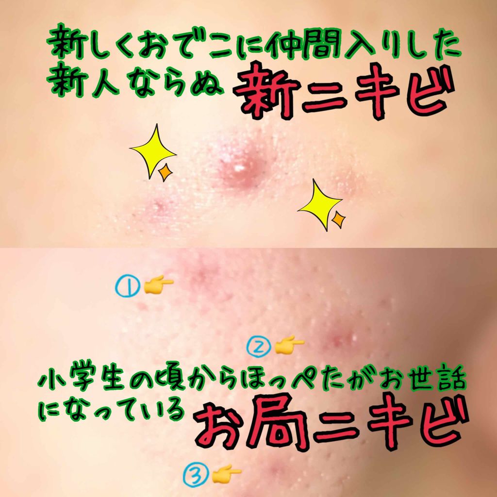 コールドクリーム/ウテナモイスチャー/クレンジングクリームを使ったクチコミ(2枚目)