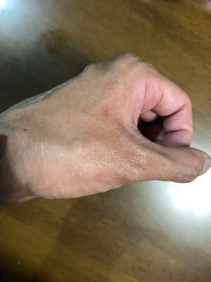 サエル ホワイトニング クリーム コンセントレート/DECENCIA/フェイスクリームを使ったクチコミ(4枚目)