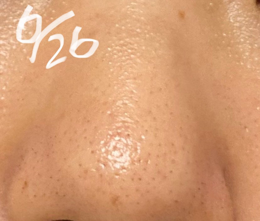 ビューティリフレッシャー/TWANY/その他洗顔料を使ったクチコミ(4枚目)