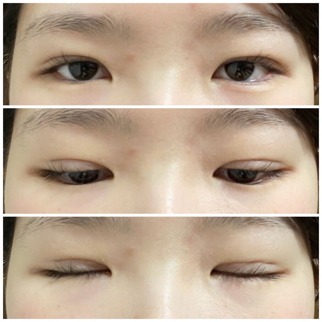 しろもち on LIPS 「3日目!!ほとんど何も変わらない。ここからは少しずつしか変わら..」(2枚目)