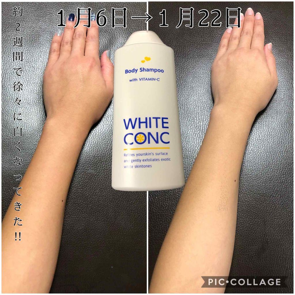 薬用ホワイトコンク ボディシャンプーC II/ホワイトコンク/ボディソープを使ったクチコミ(1枚目)