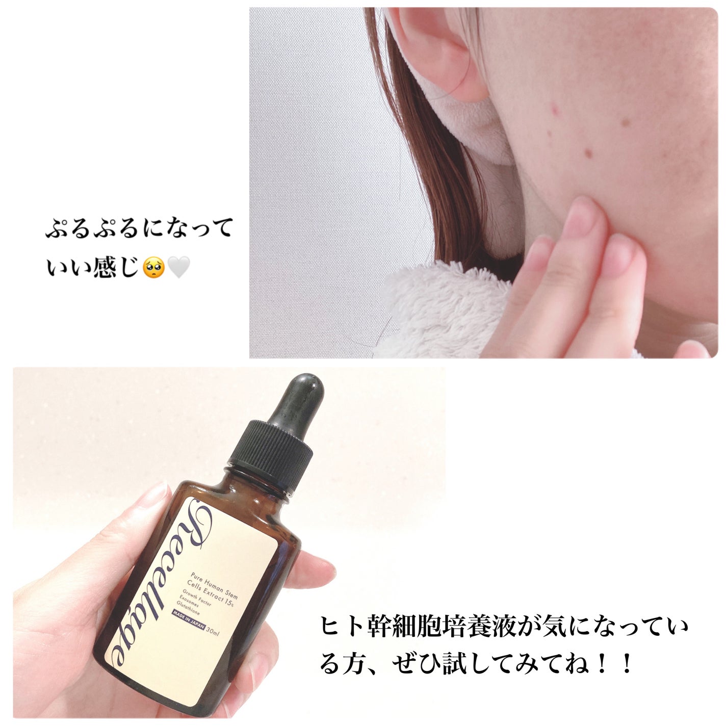 リセラージュ 美容液 /Recellage/美容液を使ったクチコミ(6枚目)