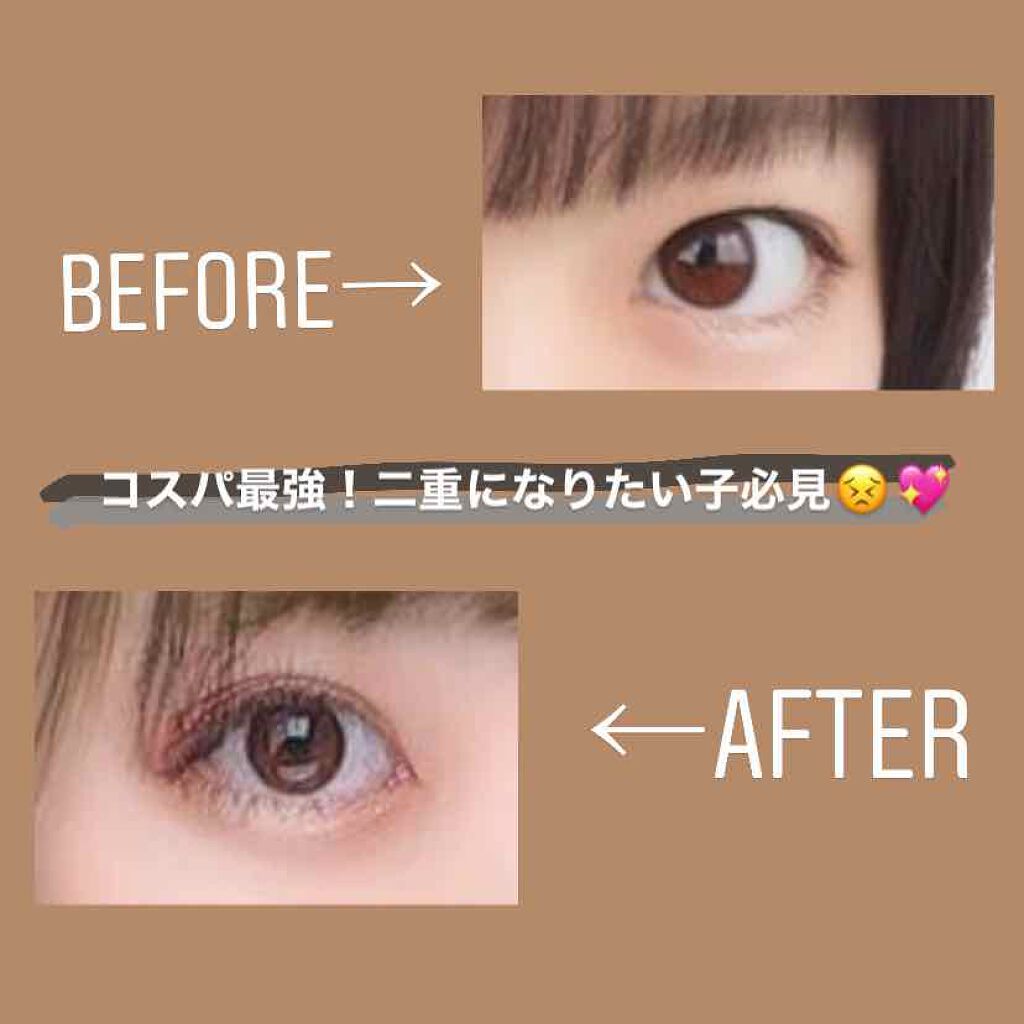 のびーるアイテープ（絆創膏タイプ、レギュラー）/DAISO/二重まぶた用アイテムを使ったクチコミ（1枚目）