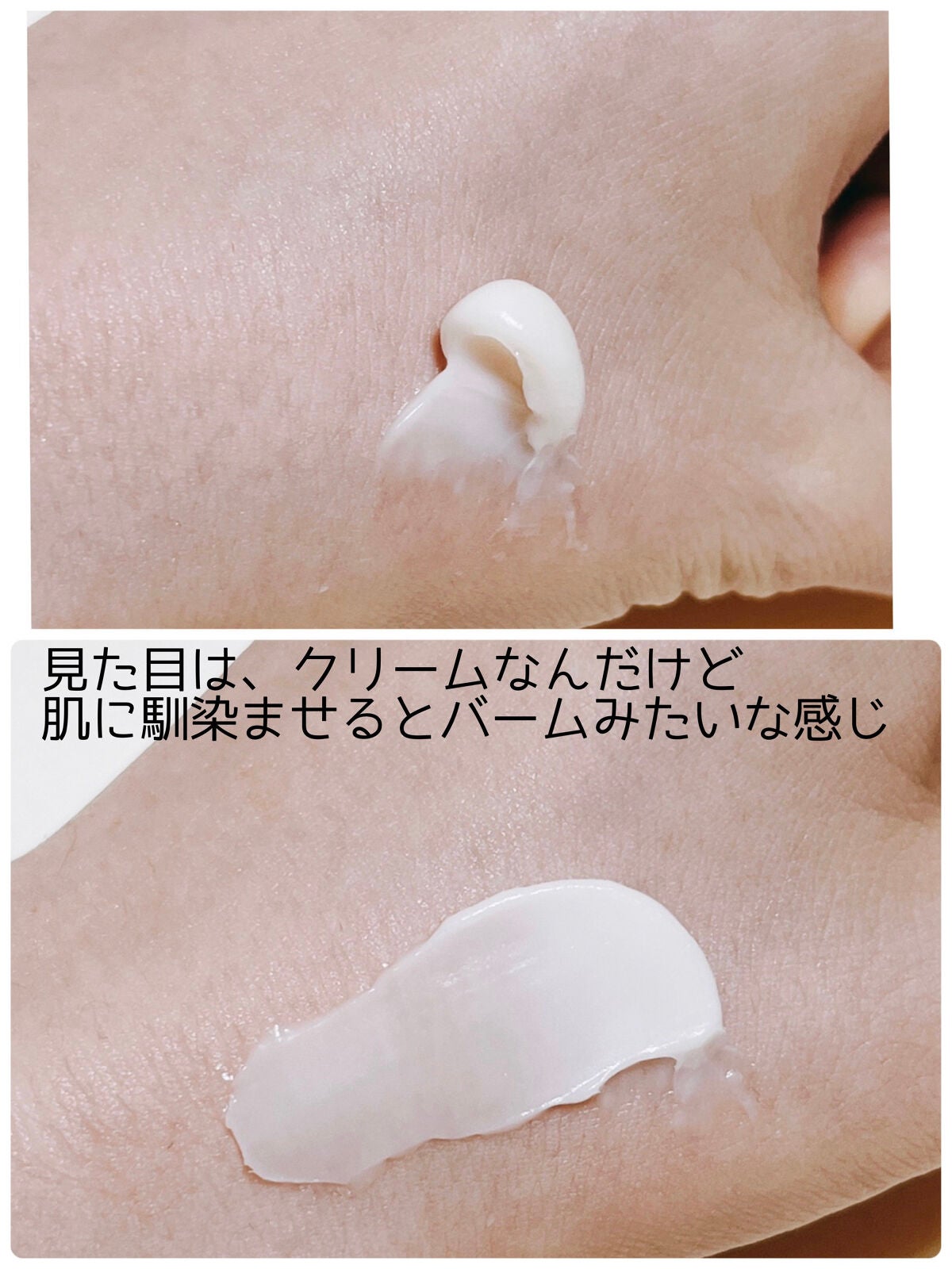 プロバイオダーム リフティング クリーム/BIOHEAL BOH/フェイスクリームを使ったクチコミ(3枚目)