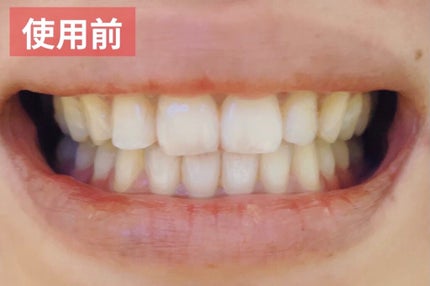 クリアクリーン プレミアム ホワイトクリアパックハミガキ/クリアクリーン/その他オーラルケアを使ったクチコミ(6枚目)