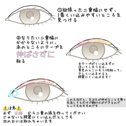 アイテープ(絆創膏タイプ、レギュラー、70枚)/DAISO/二重まぶた用アイテムを使ったクチコミ(2枚目)