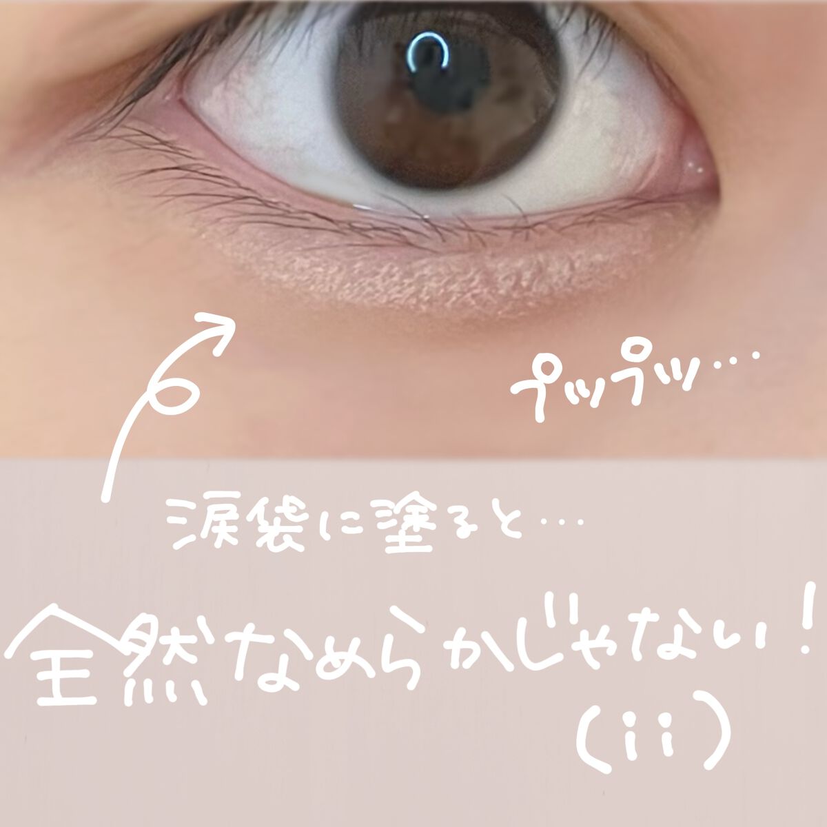 アイバッグコンシーラー/キャンメイク/ペンシルコンシーラーを使ったクチコミ(3枚目)