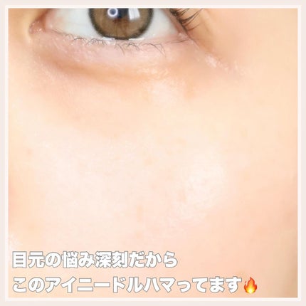 高濃度ビタミンC/17skin/美容サプリメントを使ったクチコミ(5枚目)