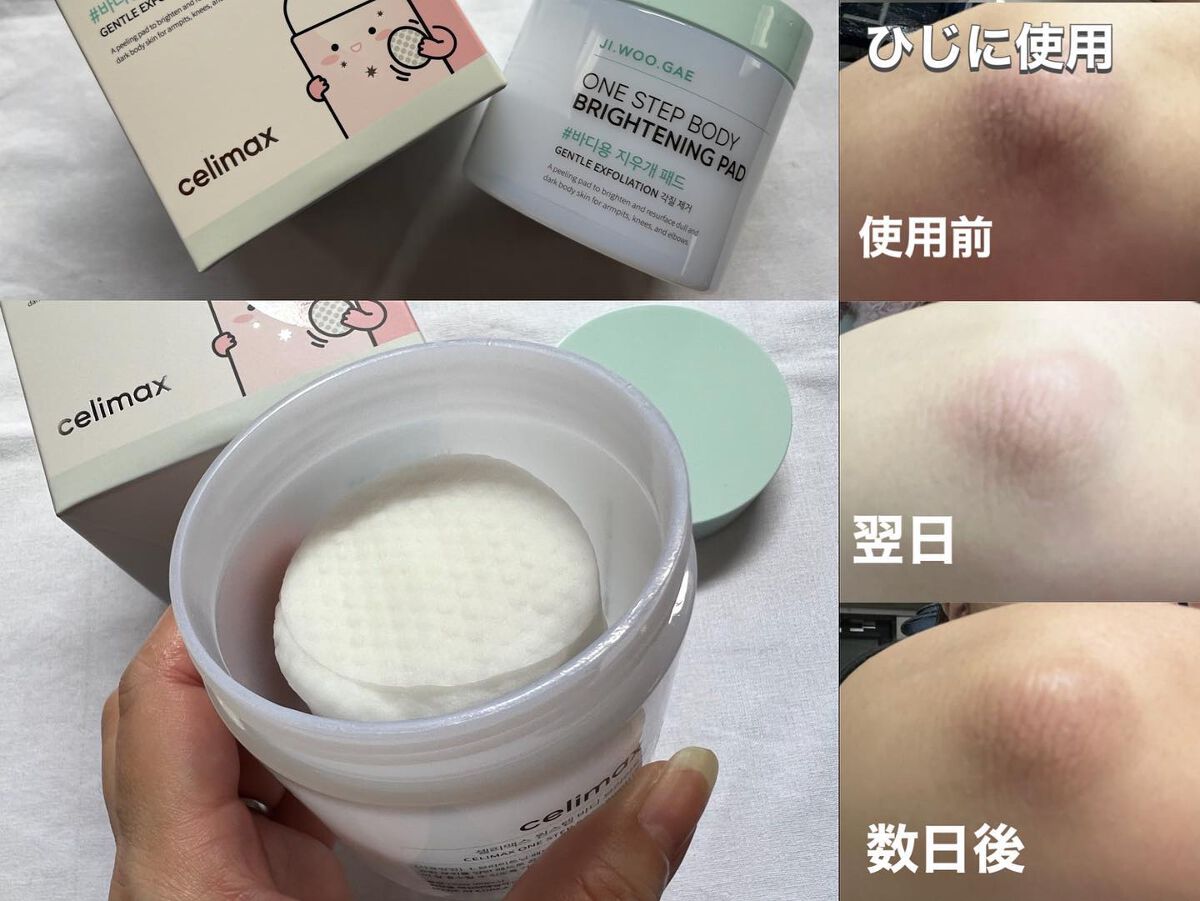 ワン ステップ ボディ ブライトニング パッド/celimax/ボディシートを使ったクチコミ(3枚目)