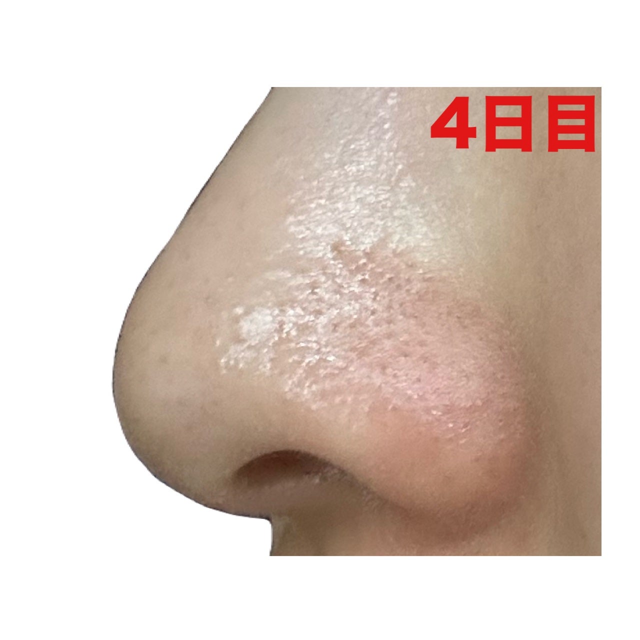 3番 緑茶炭毛穴パッククレンジングバーム/numbuzin/クレンジングバームを使ったクチコミ(6枚目)