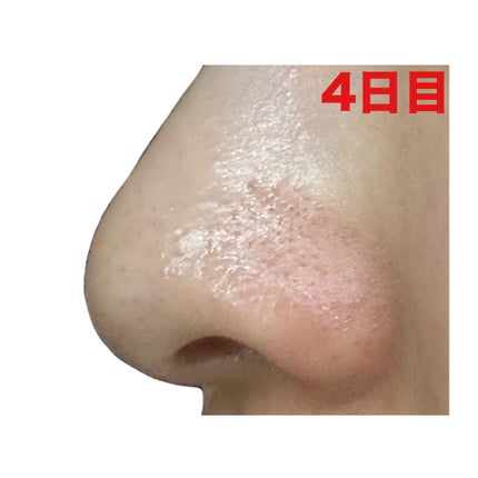 3番 緑茶炭毛穴パッククレンジングバーム/numbuzin/クレンジングバームを使ったクチコミ(6枚目)