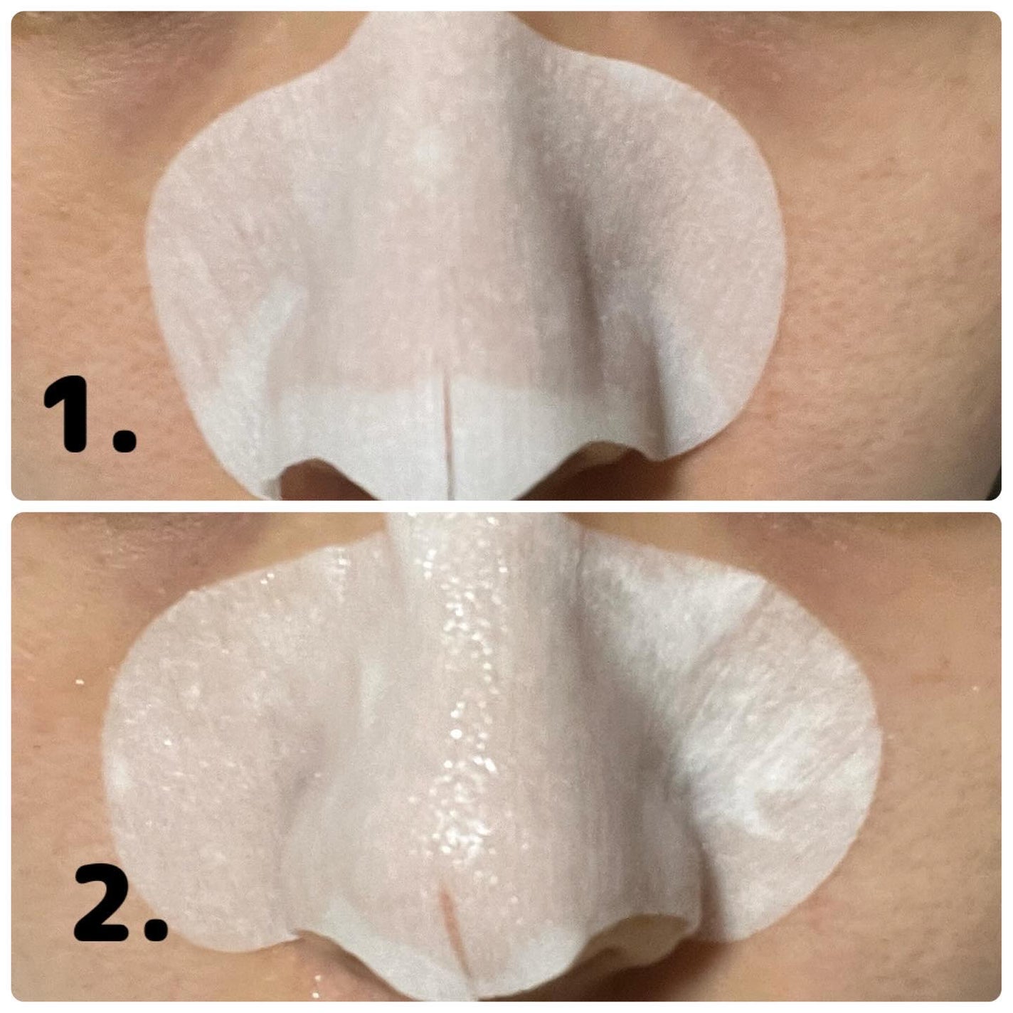 アンチポアブラックヘッドパーフェクトクリアキット/CNP Laboratory/シートマスク・パックを使ったクチコミ(4枚目)