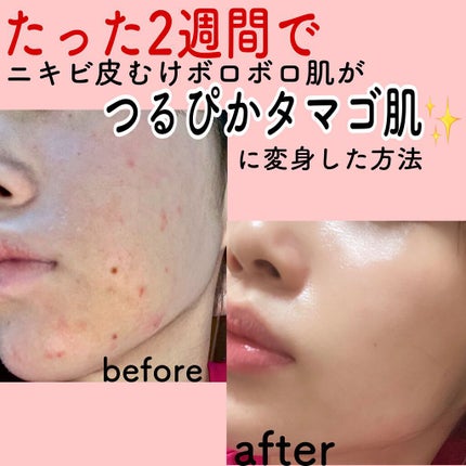 ハトムギ化粧水(ナチュリエ スキンコンディショナー R )/ナチュリエ/化粧水を使ったクチコミ(1枚目)