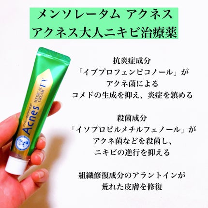 ニキビ治療薬(医薬品)/メンソレータム アクネス/その他を使ったクチコミ(2枚目)
