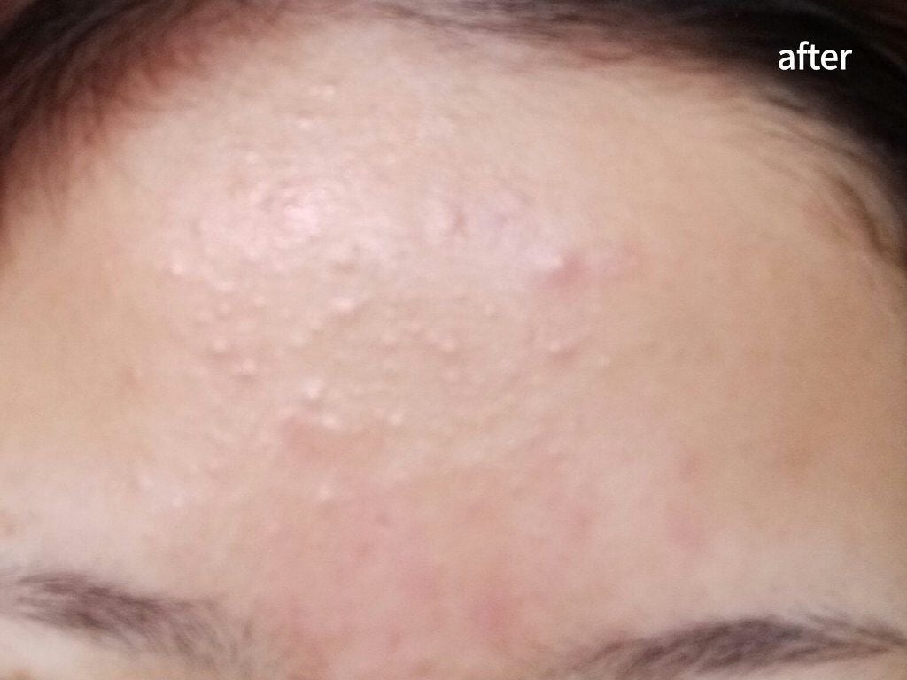 泡の洗顔料/カウブランド無添加/泡洗顔を使ったクチコミ(1枚目)