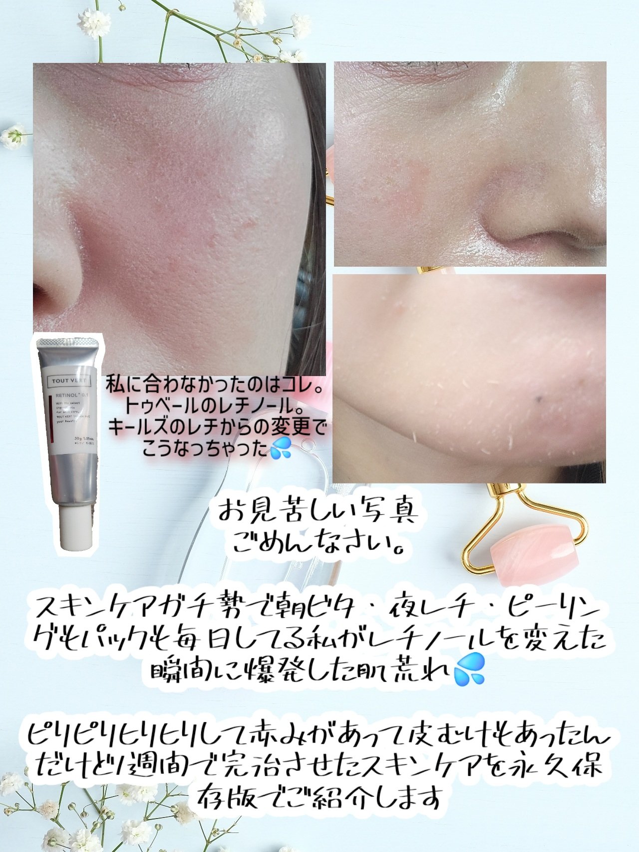 セラムオプティマイザー/AYURA/美容液を使ったクチコミ（2枚目）