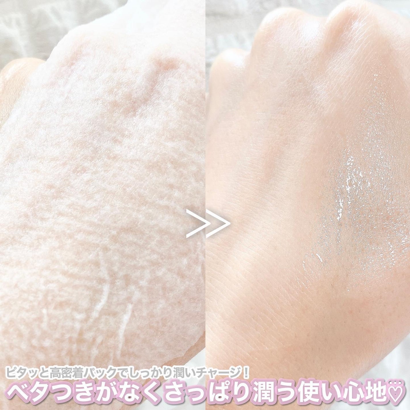 ルルルンピュア エブリーズ/ルルルン/シートマスク・パックを使ったクチコミ(6枚目)