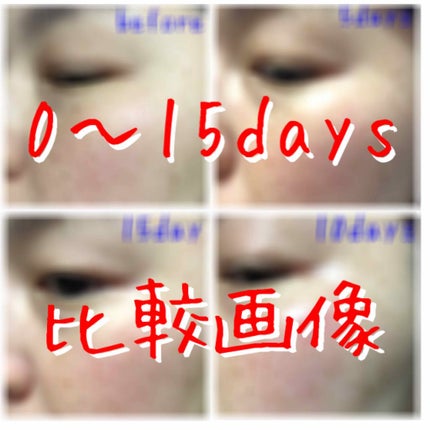 ホワイト 薬用ドットゼロ/リッツ/美容液を使ったクチコミ(1枚目)