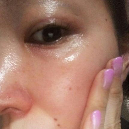 美容液化粧水/麗凍化粧品/化粧水を使ったクチコミ(3枚目)