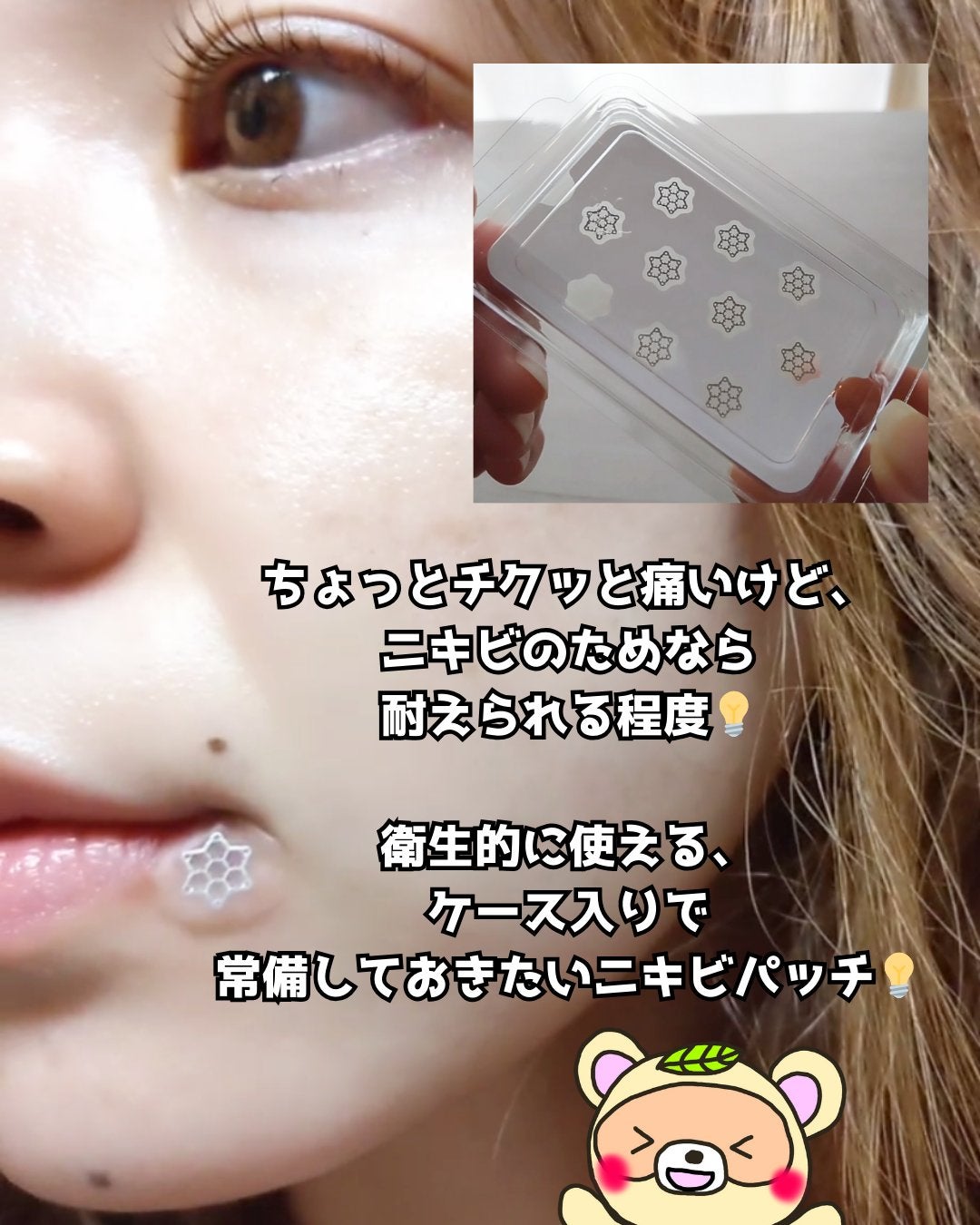 ACマグネシウムパッチ ミニ/スノーツープラス/にきびパッチを使ったクチコミ(3枚目)