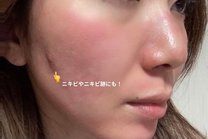 を使ったクチコミ(3枚目)