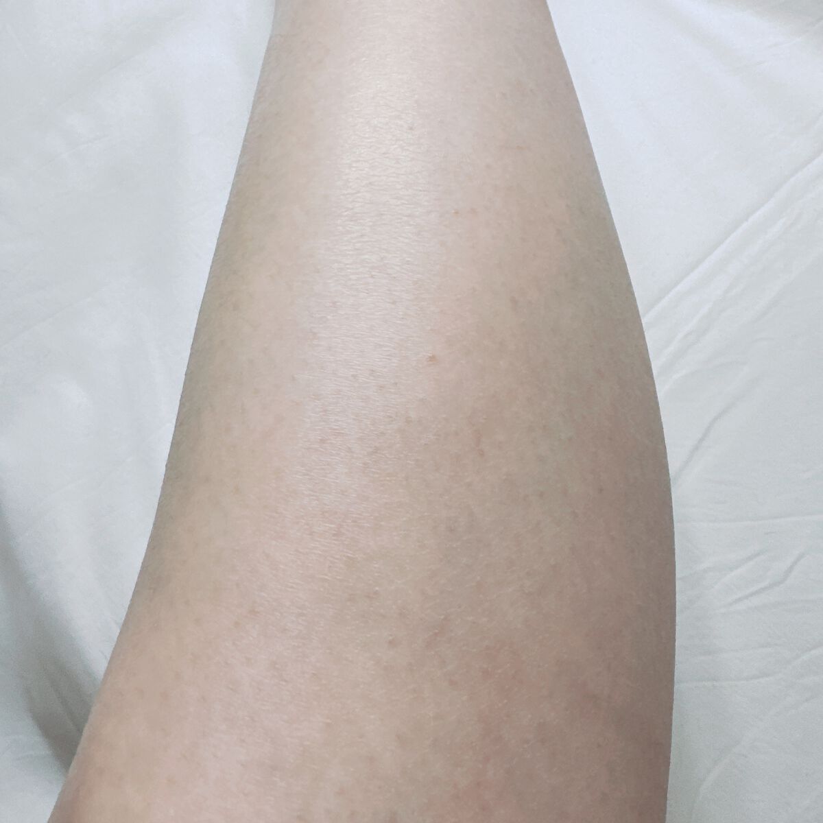 コードレス脱毛器/Noend/家庭用脱毛器を使ったクチコミ(4枚目)