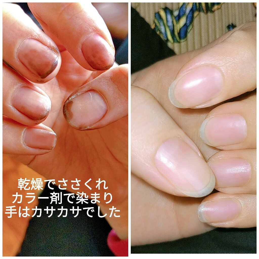 CCキューティクルオイル ローズ 保湿オイル ペンタイプ/プリジェル/美容液を使ったクチコミ(1枚目)