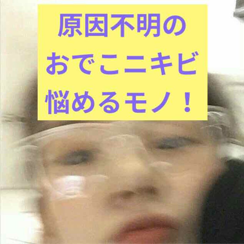 ノブ A アクネソープ/NOV/洗顔石鹸を使ったクチコミ(1枚目)