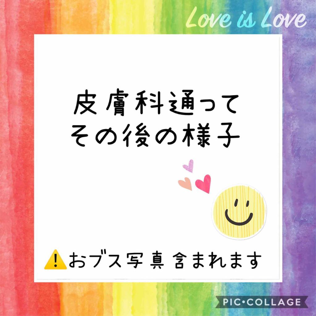 薬用パウダー化粧水/メンソレータム アクネス/化粧水を使ったクチコミ(1枚目)