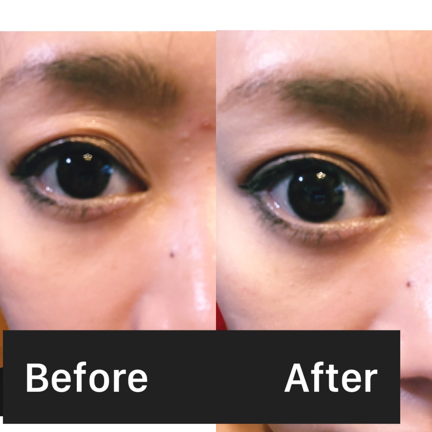 TWOOL ダブルアイリッドグルー/SHOBIDO/二重まぶた用アイテムを使ったクチコミ(4枚目)