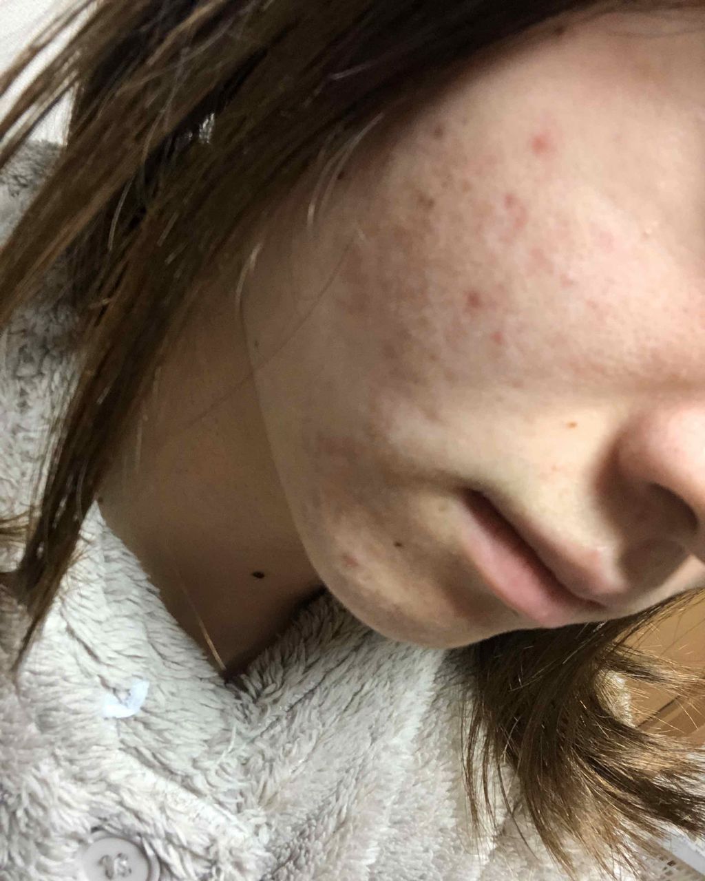 マンスリースキンケアプログラム(旧)/APEX/スキンケアキットを使ったクチコミ(3枚目)