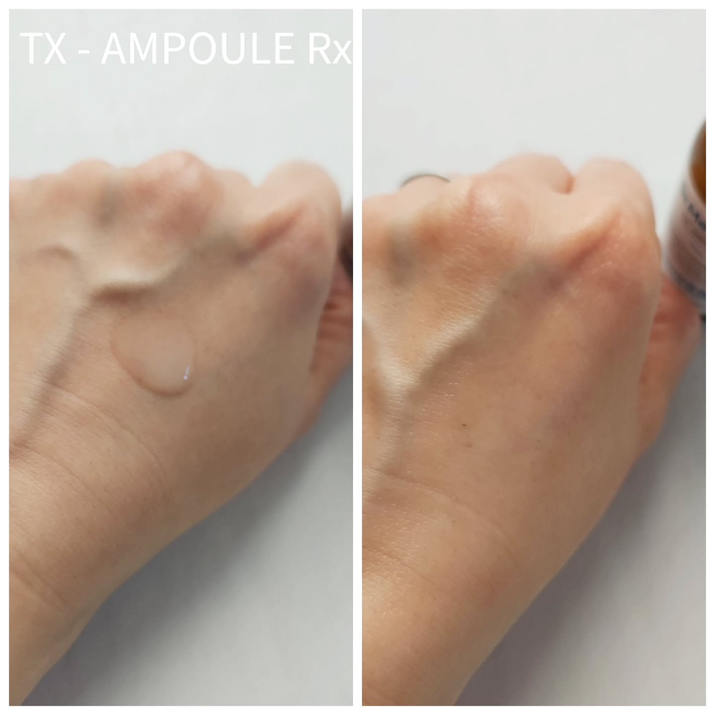 TX-Cream/Dr.Melaxin/フェイスクリームを使ったクチコミ（2枚目）