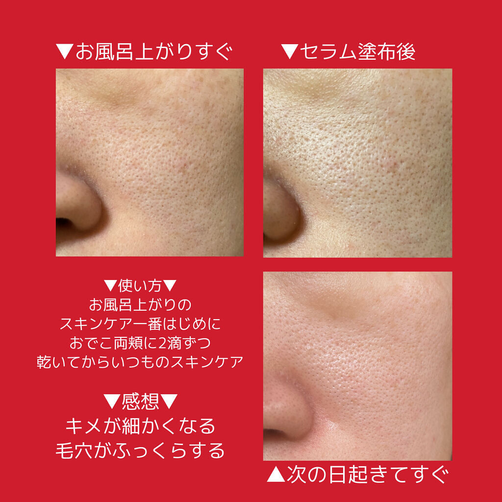 マンデリック インテンシブ 18%セラム/DR.WU/美容液を使ったクチコミ（2枚目）