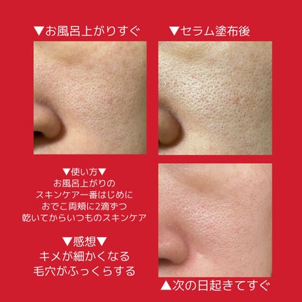 マンデリック インテンシブ 18%セラム/DR.WU/美容液を使ったクチコミ(2枚目)