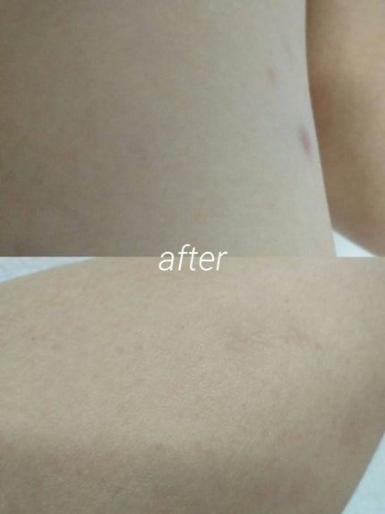 ナチュラルズ バスタイム除毛クリーム 敏感肌用/Veet/除毛クリームを使ったクチコミ(3枚目)