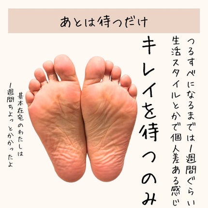 イージーパックDP60分タイプ/ベビーフット/レッグ・フットケアを使ったクチコミ(5枚目)