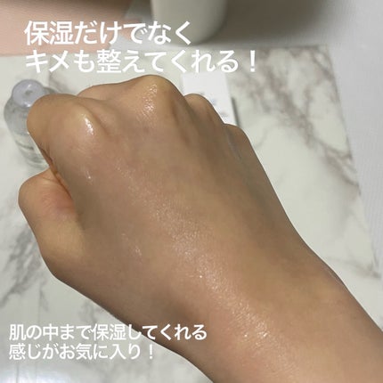 アクアヒアルロニックエッセンス/ロベクチン/化粧水を使ったクチコミ(4枚目)