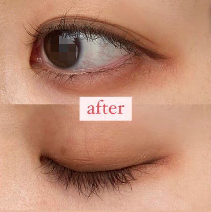 オリシキ アイリッドスキンフィルム		/D-UP/二重まぶた用アイテムを使ったクチコミ(3枚目)