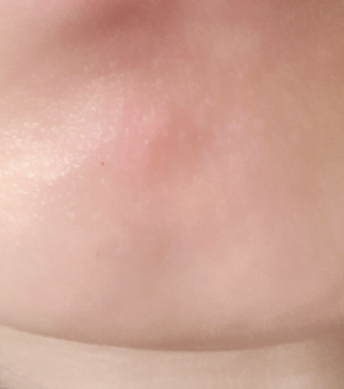 ハトムギ化粧水(ナチュリエ スキンコンディショナー R )/ナチュリエ/化粧水を使ったクチコミ（2枚目）